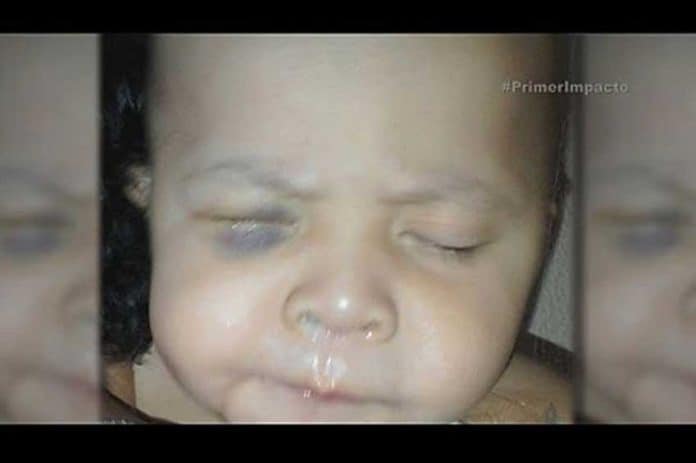 The baby who was left blind by botched surgery in Sonora.