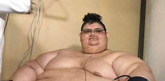 Franco weighs half what he used to.