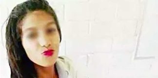 The 15-year-old victim of Rapunzel syndrome.