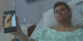 Alex Wilton with a photo of the shark bite.