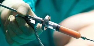 A liposuction procedure proved tragic in Tabasco.