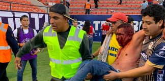 Beaten and bloodied, a fan is carried from the stadium on Sunday.