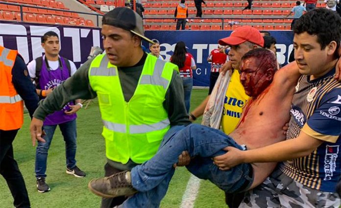 Beaten and bloodied, a fan is carried from the stadium on Sunday.