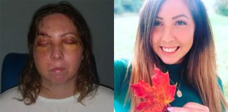 Leslie York, before and after her ordeal in a Tulum hotel.