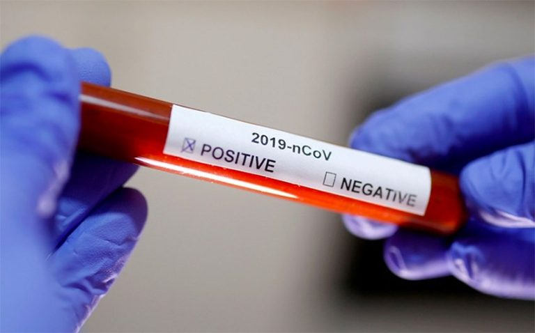 Increased calls for more coronavirus testing before returning to ‘new normal’ Increased calls for more coronavirus testing before returning to ‘new normal’