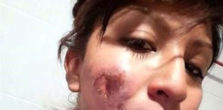 Officer Velasco: attacked during Sunday's Women's Day march.