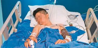 The young man who lost a leg after police stopped a vehicle in Acapulco.