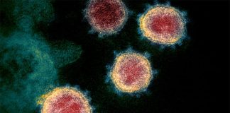 An electron microscope photograph of SARS-Cov-2, the virus that causes COVID-19