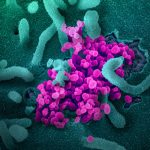 A scanning electron microscope image shows SARS-CoV-2 (round magenta objects) emerging from the surface of cells cultured in the lab. SARS-CoV-2, also known as 2019-nCoV, is the virus that causes COVID-19.