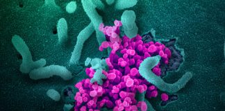 A scanning electron microscope image shows SARS-CoV-2 (round magenta objects) emerging from the surface of cells cultured in the lab. SARS-CoV-2, also known as 2019-nCoV, is the virus that causes COVID-19.
