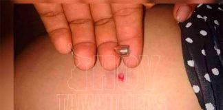 A pregnant Tamaulipas woman