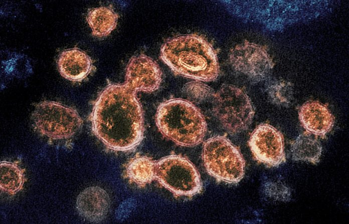A transmission electron microscope image shows SARS-CoV-2, the virus that causes COVID-19, isolated from a patient in the U.S. Virus particles are shown emerging from the surface of cells. The spikes on the outer edge of the virus particles give coronaviruses their name, which means crown-like.