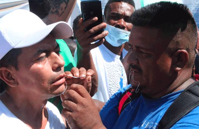 Migrants performed the lip-sewing operation on each other