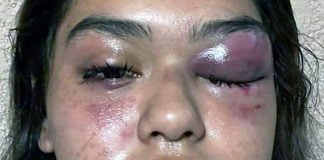 San Miguel de Allende, Guanajuato police brutality victim