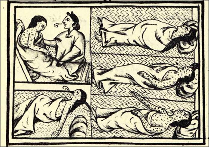 Smallpox depictions in the Florentine Codex