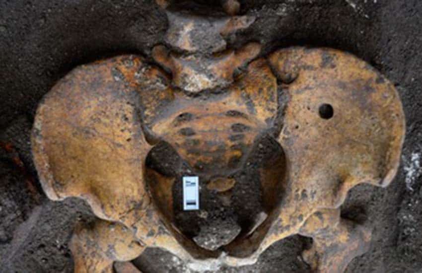 hip bone with bullet hole from 19th century remains Mexico