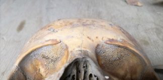 Skull analysis showed that the oldest Mexica child died of an illness related to anemia, disease and dietary imbalance.