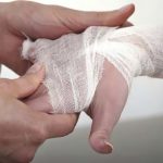 Woman's hand in bandage