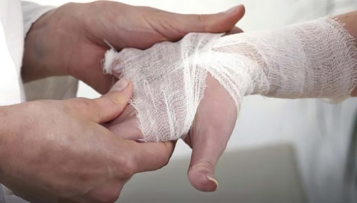 Woman's hand in bandage