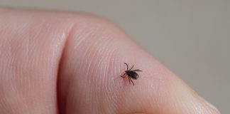 A small black tick on a person's hand