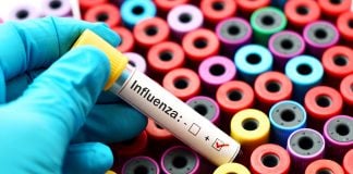 Test tube marked influenza