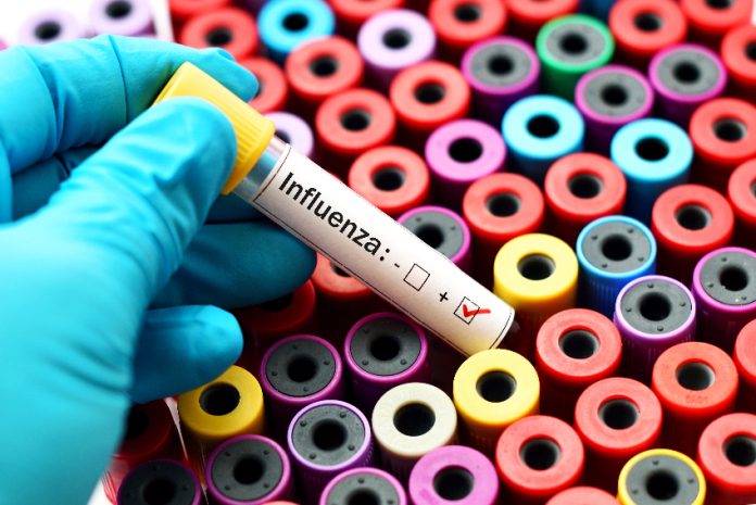 Test tube marked influenza