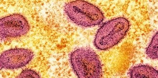 Mexican health officials on Thursday reported that there have been 212 “probable cases” this year with 49 confirmed