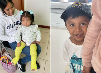 Two children, patients of Kids First Orthopaedics, smile at the camera. One little girl has casts on both legs. The other, a little boy, hides behind his mother