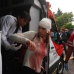 Hurt person who received medical care from the Mexican Red Cross at the Oct. 11 protest in Guadalajara demanding clean tap water