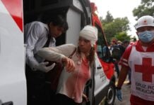 Hurt person who received medical care from the Mexican Red Cross at the Oct. 11 protest in Guadalajara demanding clean tap water